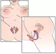 Intimate Spreader Levittäjä - Klitoriskiihottimet ja Muut Hierojat - 4024144504374 - 5