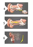 Pumped Penis Extender Peniksenvenytin - Peniksen pidennys - 8714273926005 - 6